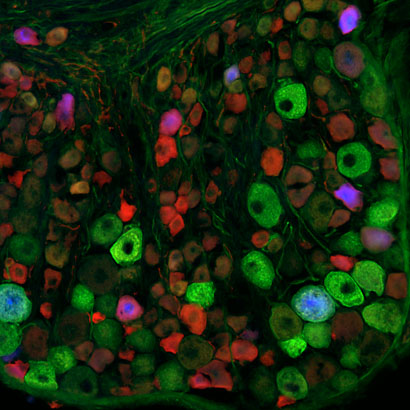  Cross-section of mouse dorsal root ganglia (DRG) with neurones innervating the distal colon labelled using the retrograde tracer Fast Blue (blue) and co-stained by fluorescence immunohistochemistry against TrkC (green) and NECAB2 (red) (Dr. J. Hockley, S