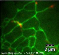 cwt-Lysosomes TIRF image